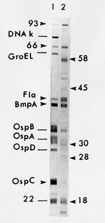 Image: Western Blot (IgG) Serodiagnostic Testing